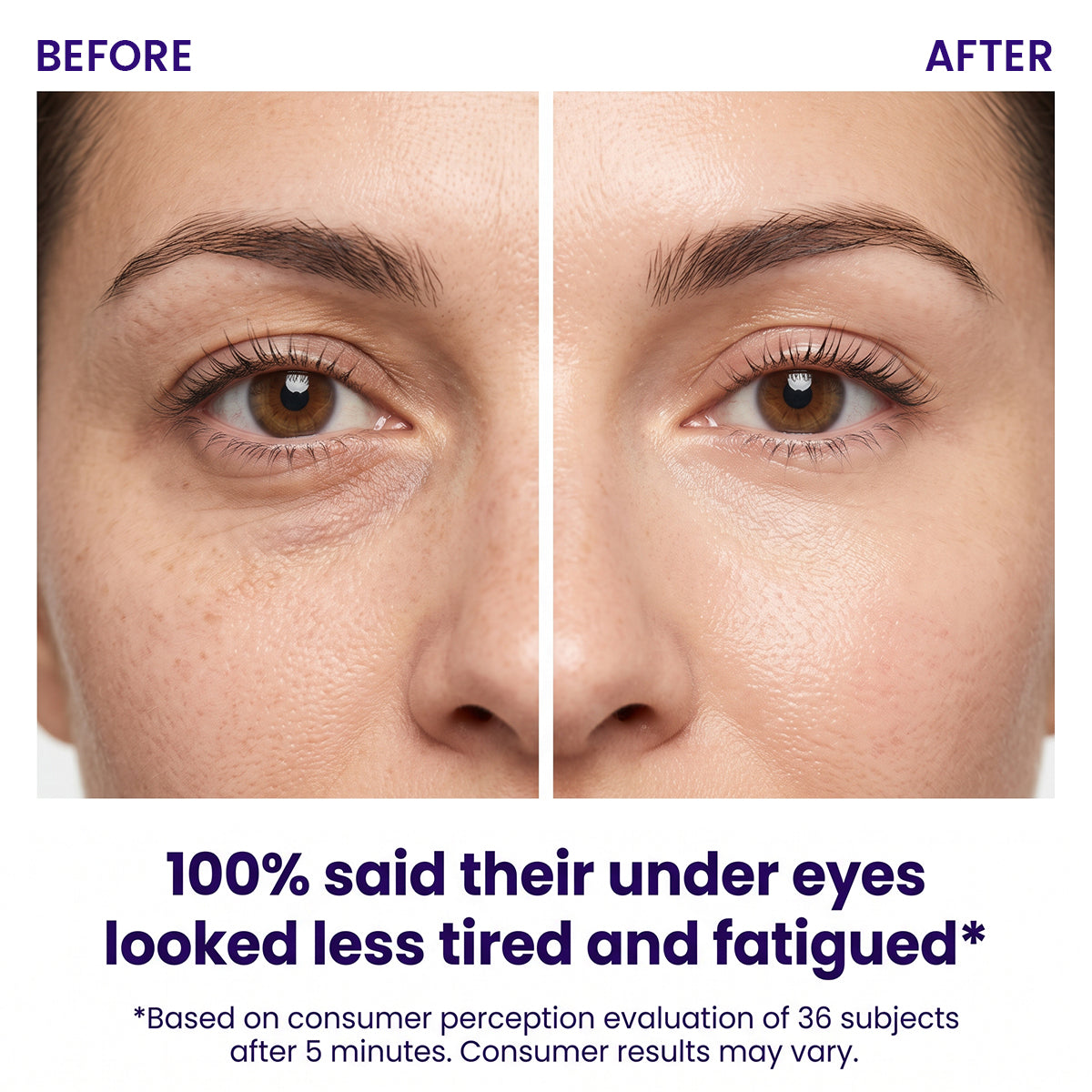 Instant Lift Eye Gel — Reduce the Look of Eye Bags in Minutes 🔥 — image 2