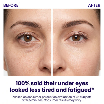 Instant Lift Eye Gel — Reduce the Look of Eye Bags in Minutes 🔥 — image 2