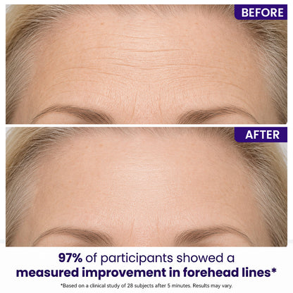 Instant Lift Eye Gel — Reduce the Look of Eye Bags in Minutes 🔥 — image 3